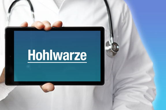 Eingezogene Brustwarzen Worms